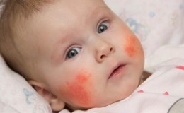 Ar kūdikiai yra alergiški grikiams