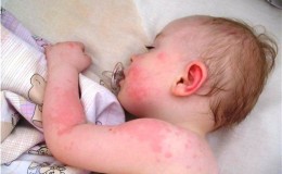 C'è un'allergia al cavolfiore nei bambini?