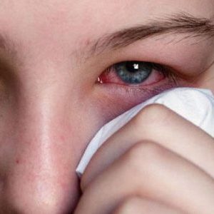 Kabak alerjisi ile ne yapılmalı: Etkili tedavi edin ve önceden önleyin
