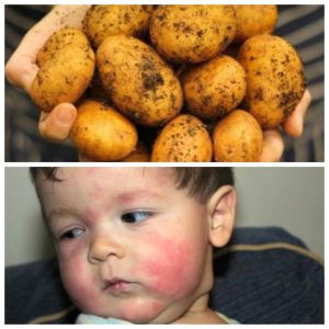 Affrontare le domande sul perché il bambino mangia patate crude ed è dannoso